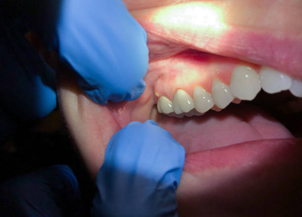 Best Orthodontic Emergency Dentist in Berea, OH